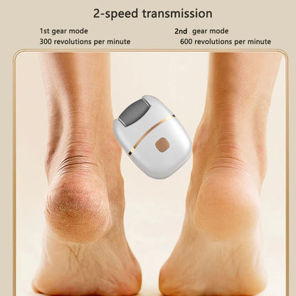 Nolyaq Heel – Portable Foot File &amp; Callus Remover